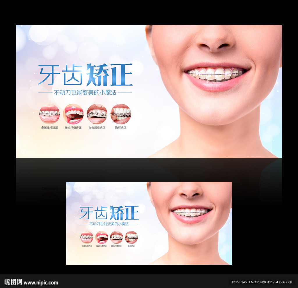 牙齿矫正