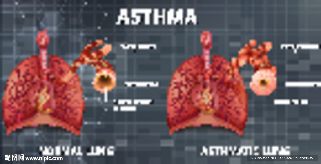 肺部哮喘结构解剖图