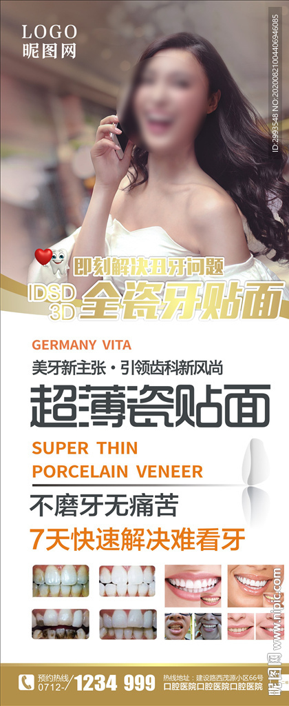 超薄瓷贴面展架图片