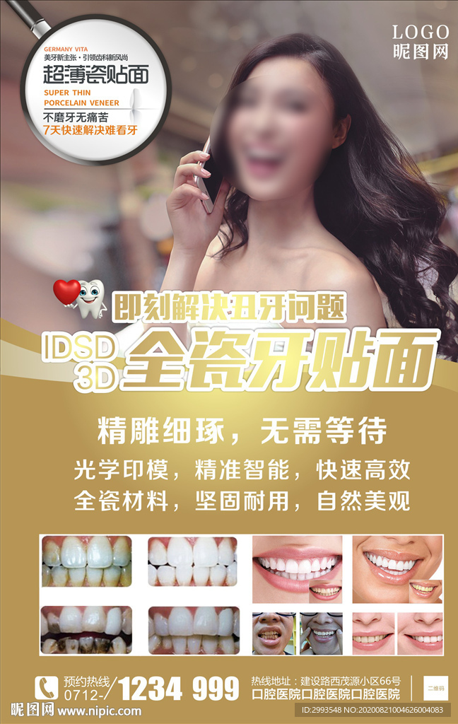 超薄瓷贴面图片