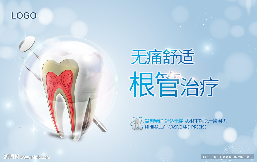 根管治疗