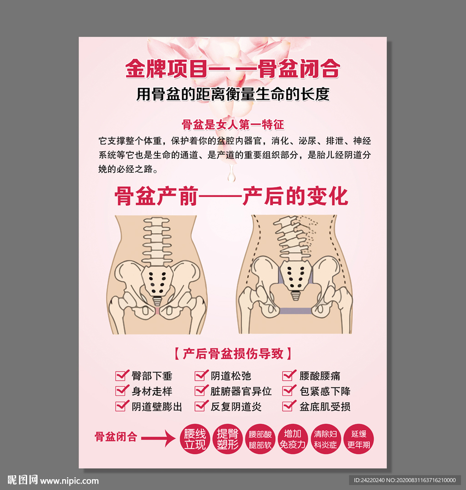 盆骨闭合海报