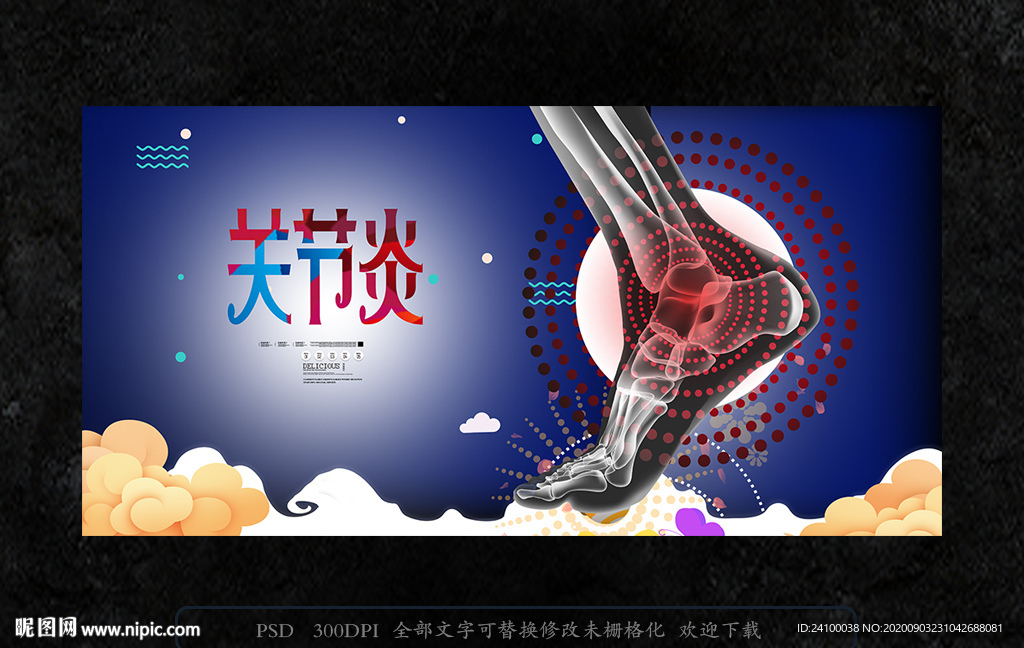 关节炎