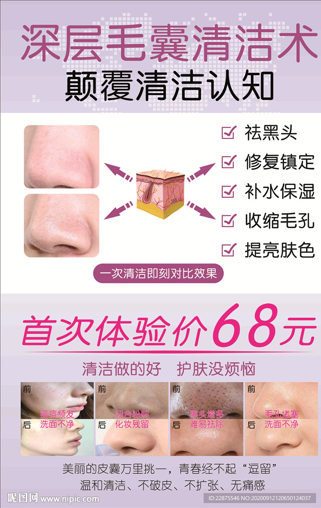 深层毛囊清洁术