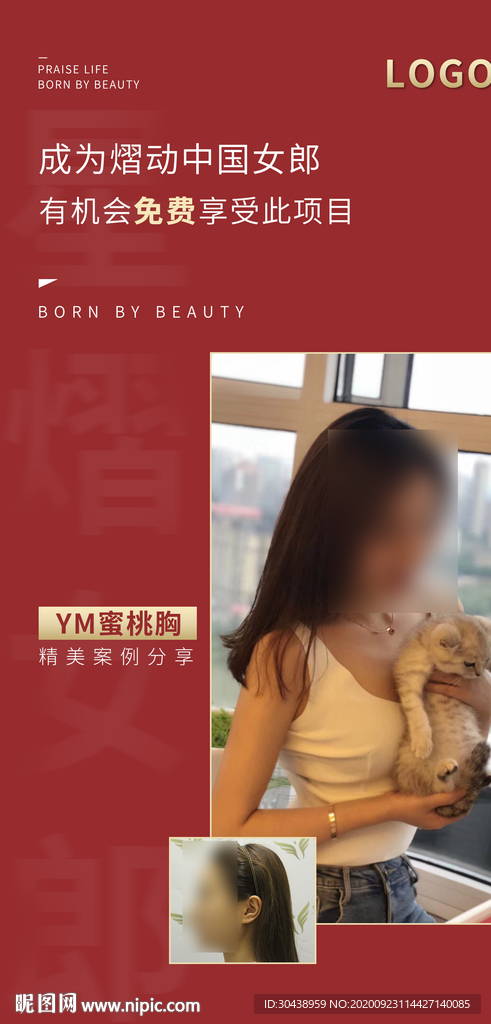 医美案例模版