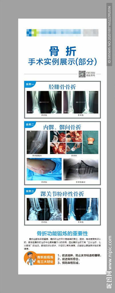 手足外科文化 骨折展板