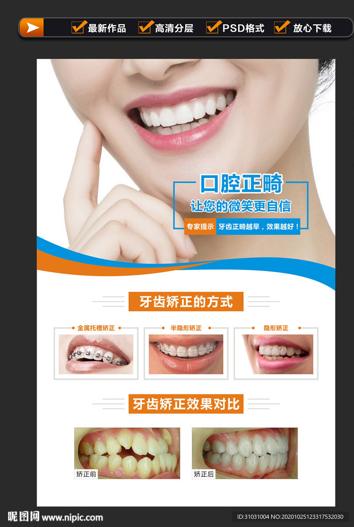 口腔正畸 牙齿矫正