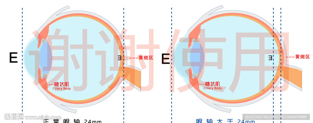 眼轴比较