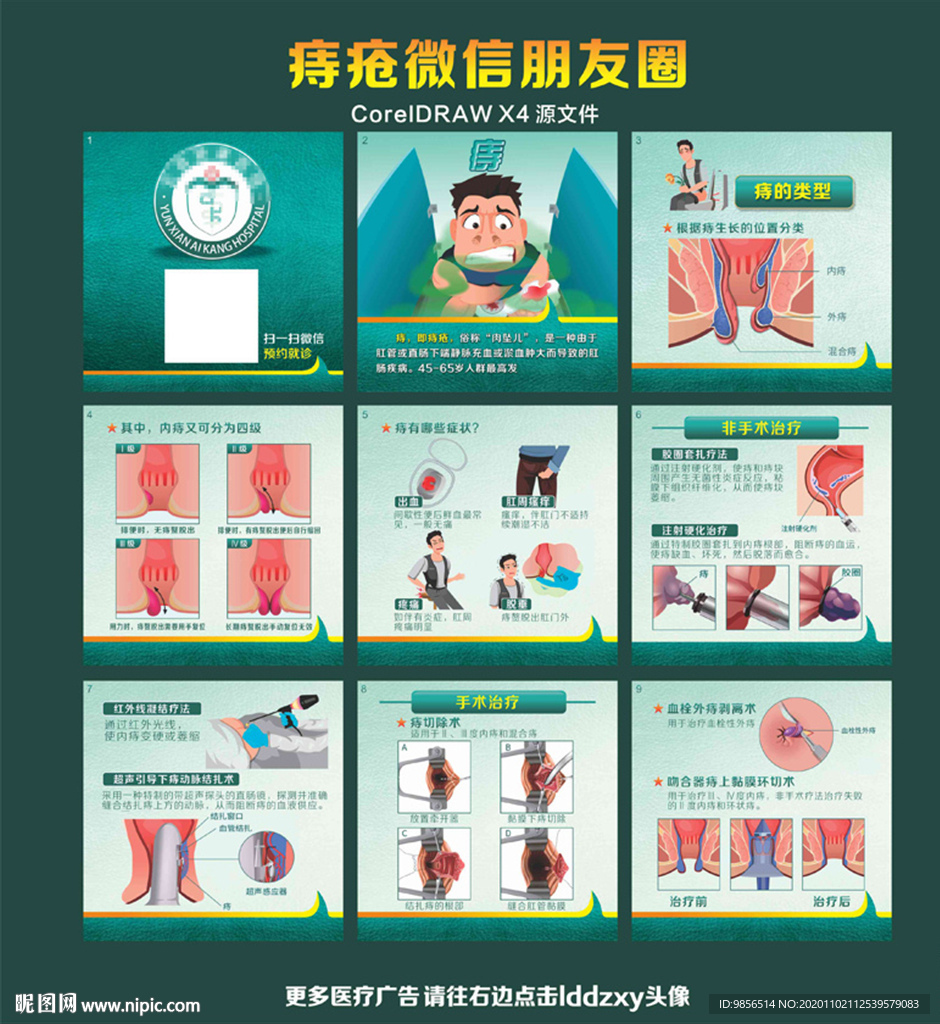 痔疮微信朋友圈医学科普