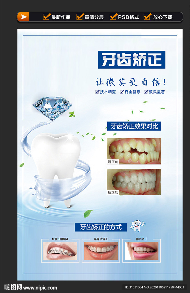 牙齿矫正