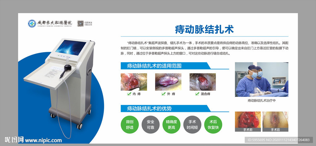 痔动脉结扎术
