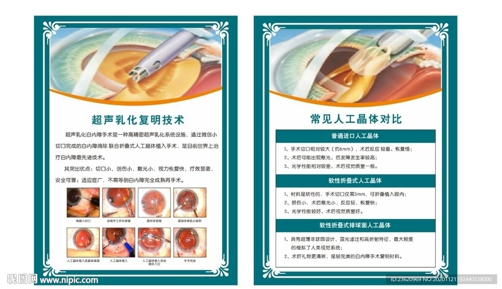 超声乳化复明技术