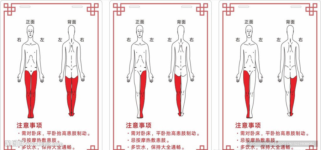 静脉血栓警示牌