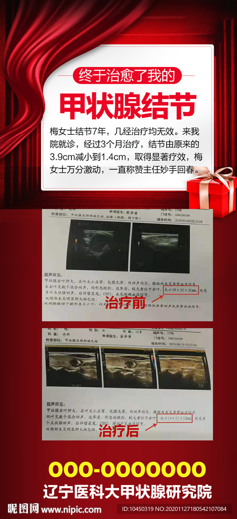 甲状腺海报 疾病海报 朋友圈