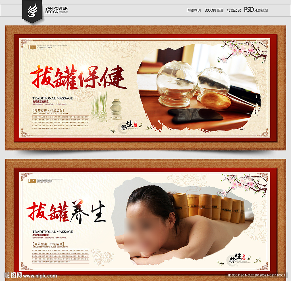 拔罐