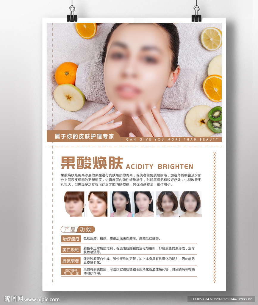 果酸焕肤