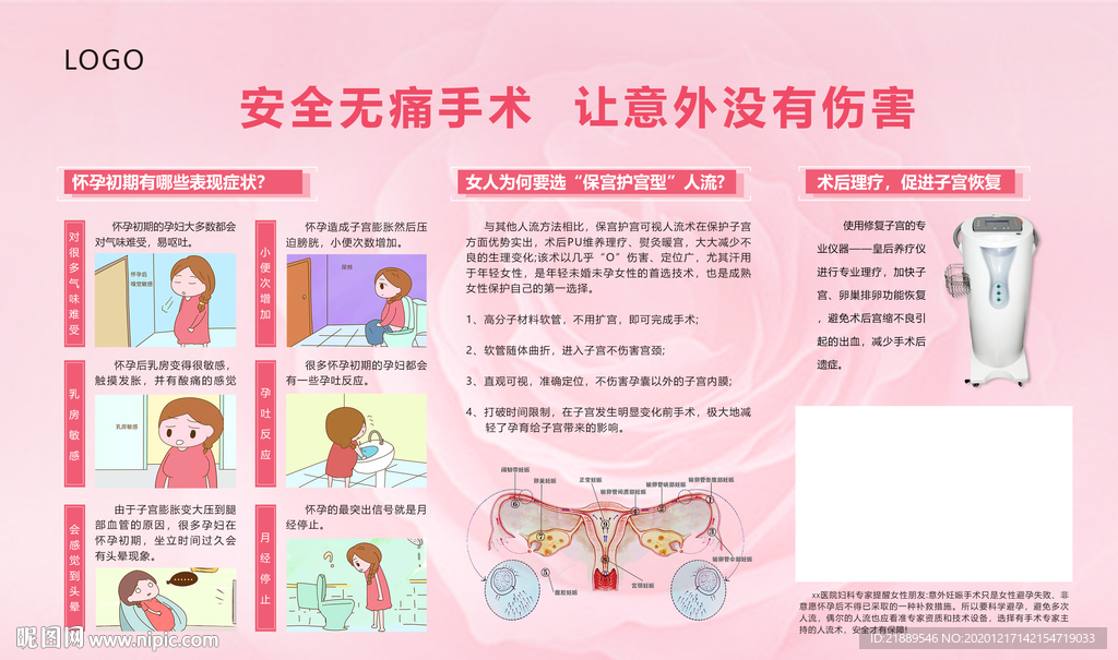 安全无痛人流