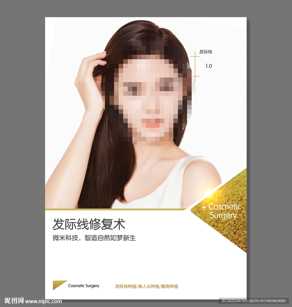 发际线修复术