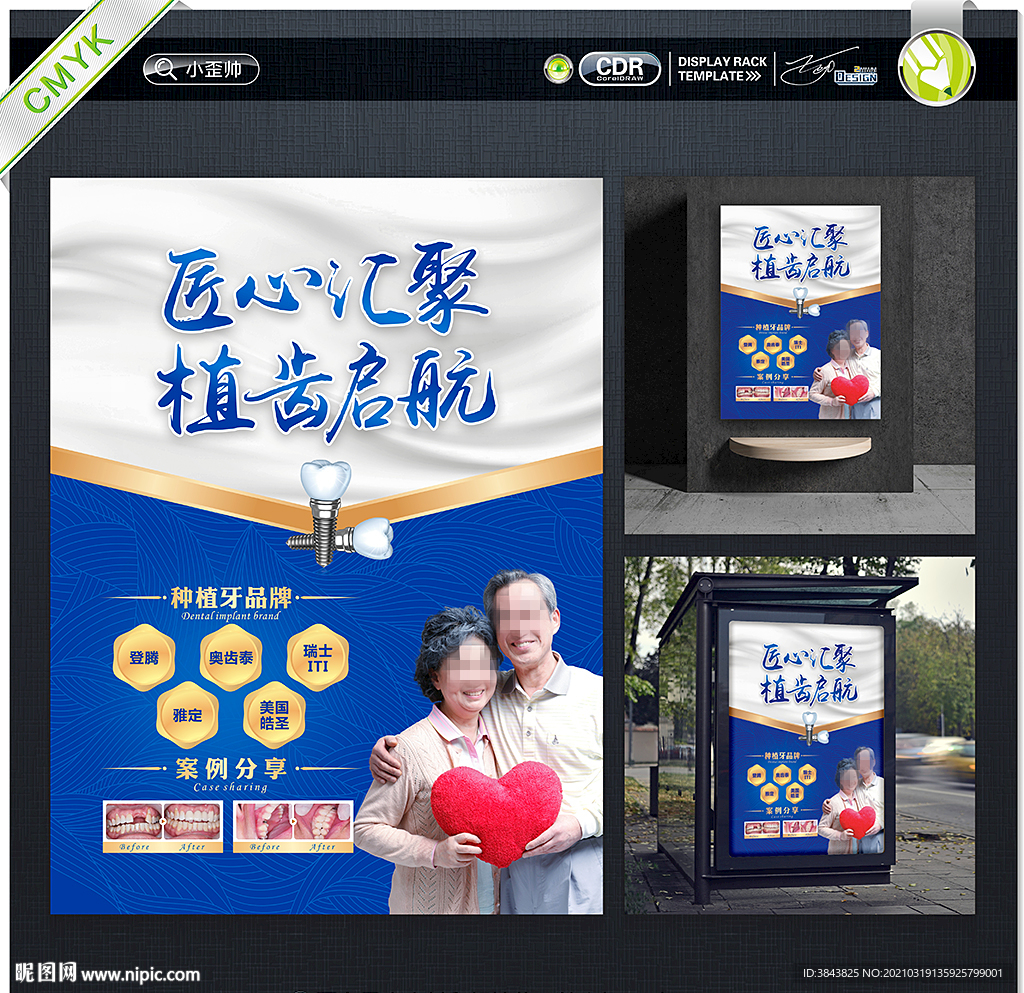 牙齿种植