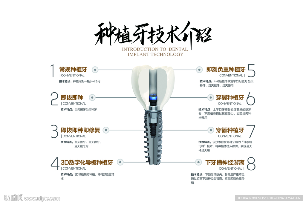 种植牙介绍灯箱