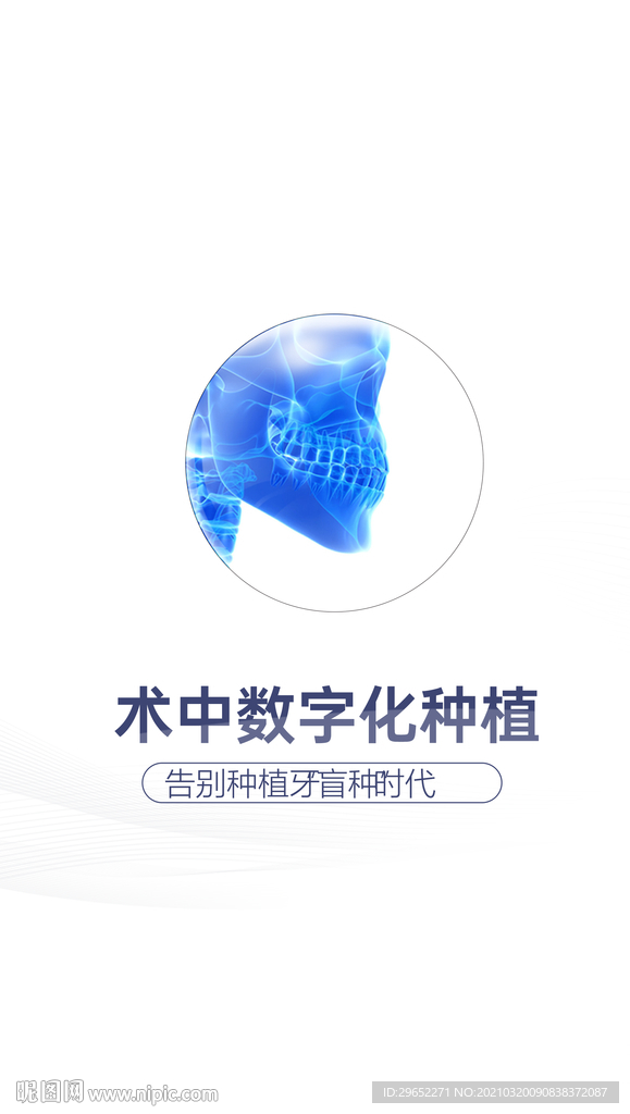 数字化种植牙
