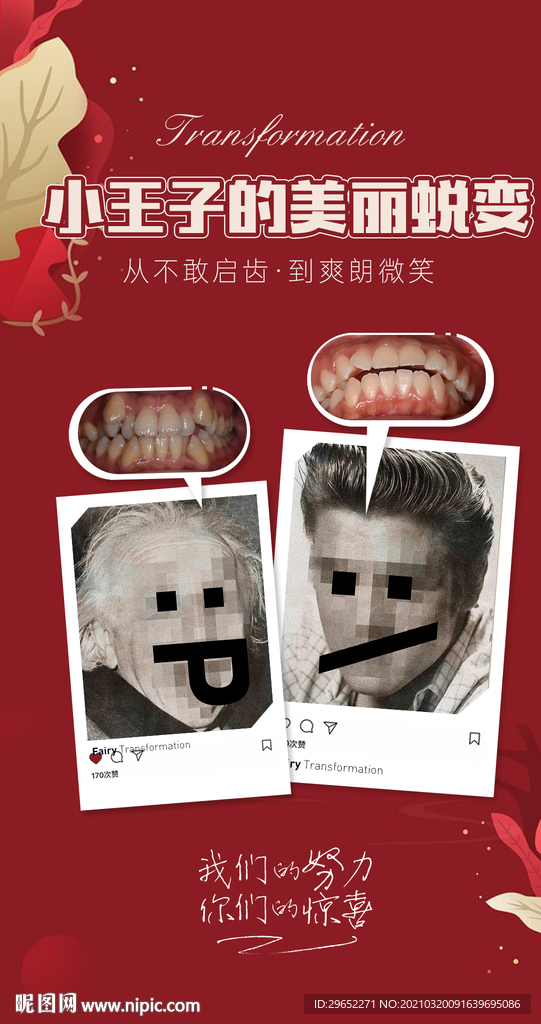 小王子的美丽蜕变