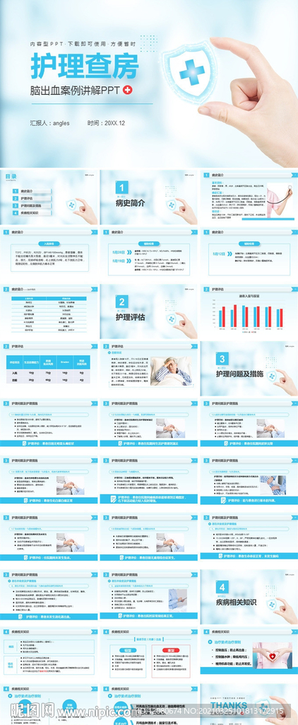 脑出血护理查房医疗医学PPT