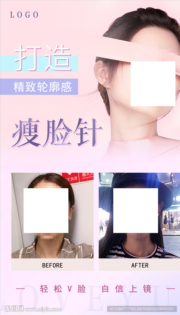 瘦脸针
