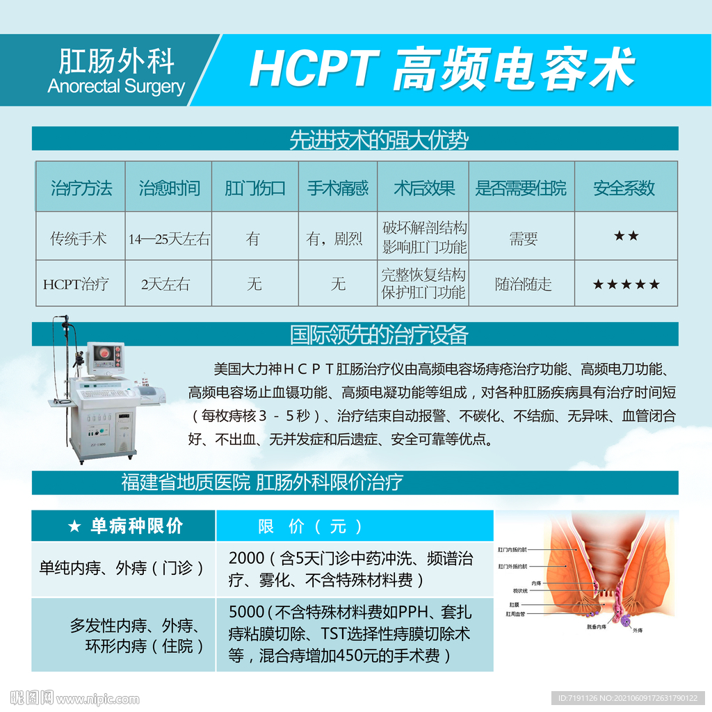 HCPT高频电容术