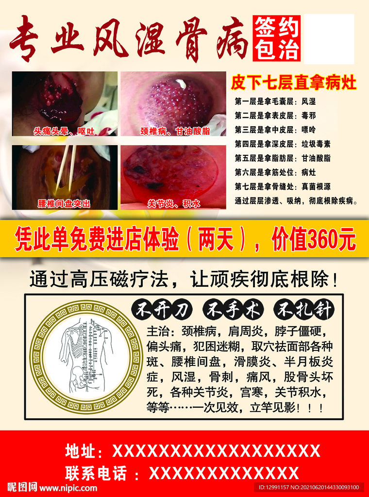 风湿骨病