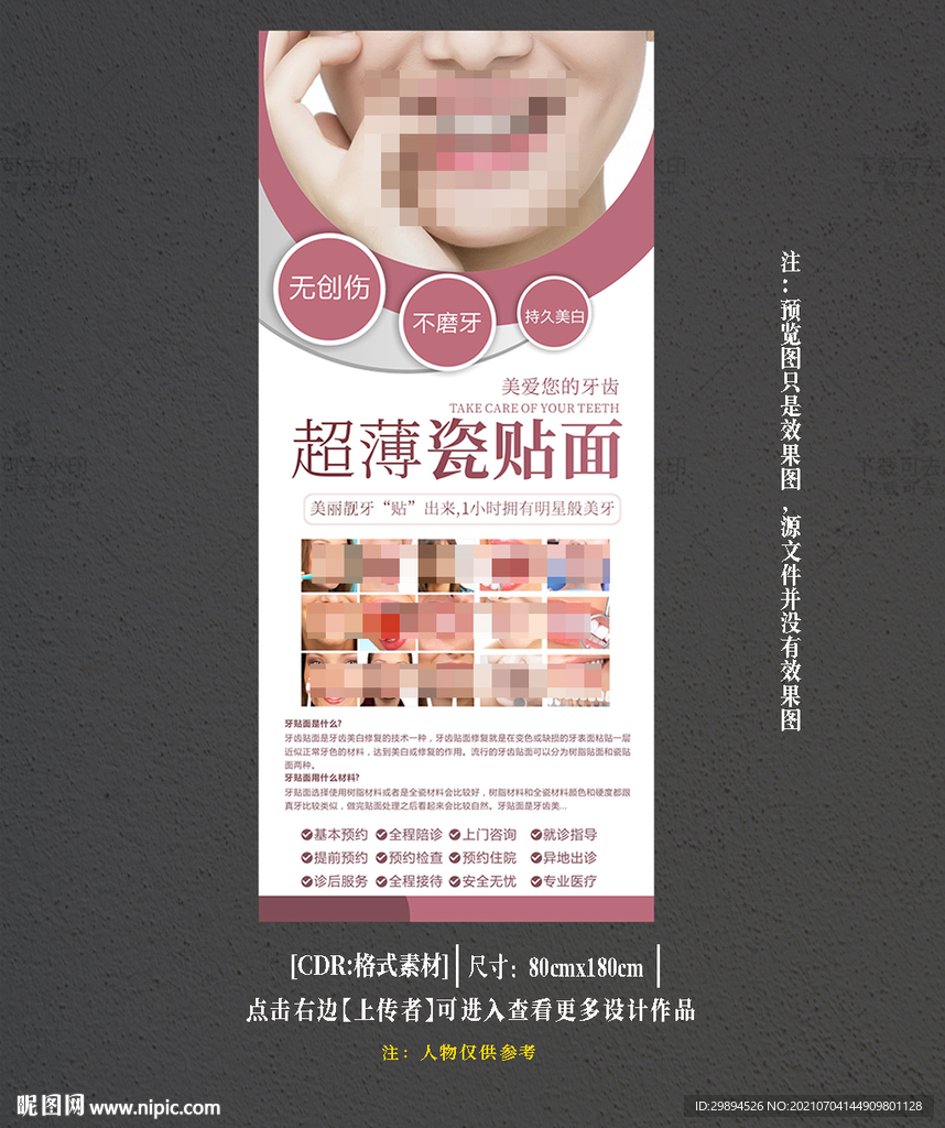 牙科超薄瓷贴面展架