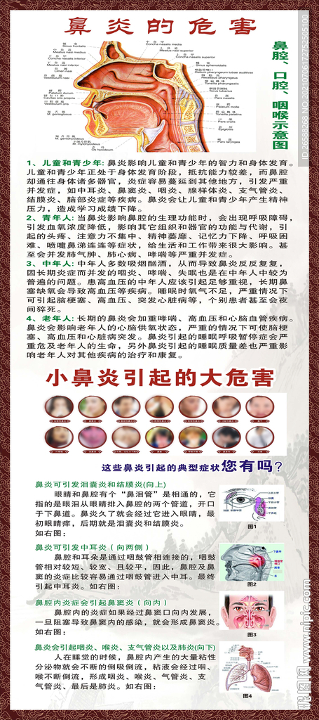 鼻炎的危害展架广告
