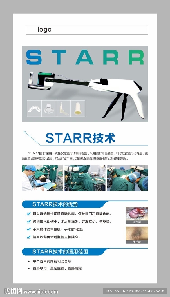 starr技术