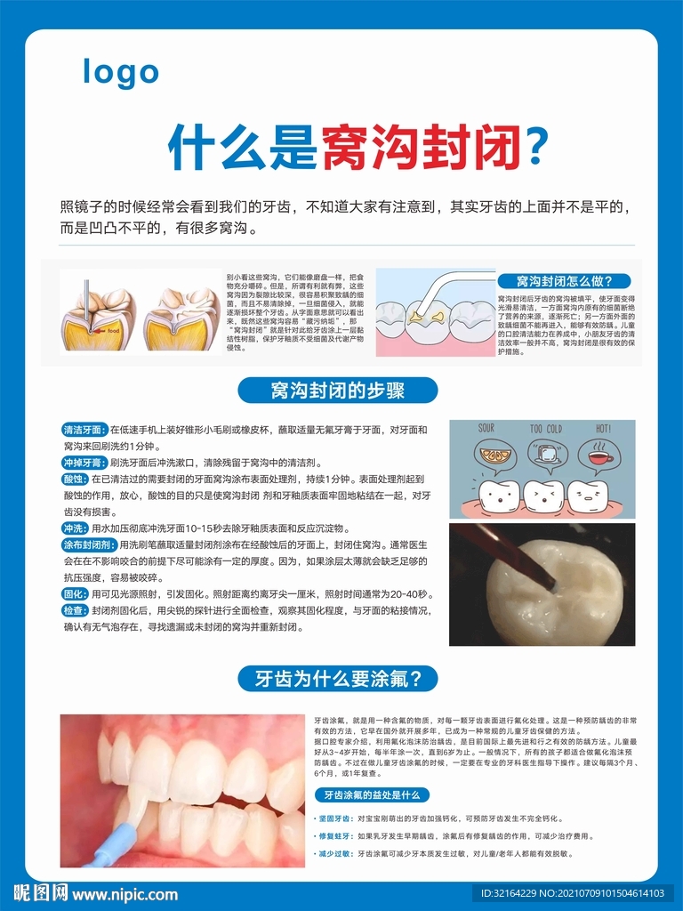 科普窝沟封闭