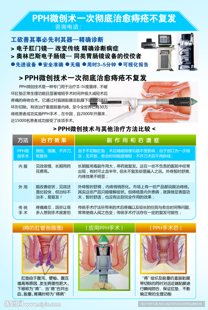 PPH微创术一次彻底治愈痔疮