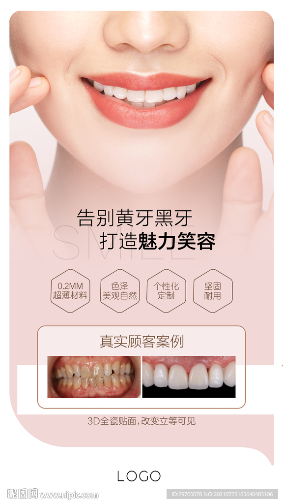 牙齿美容海报