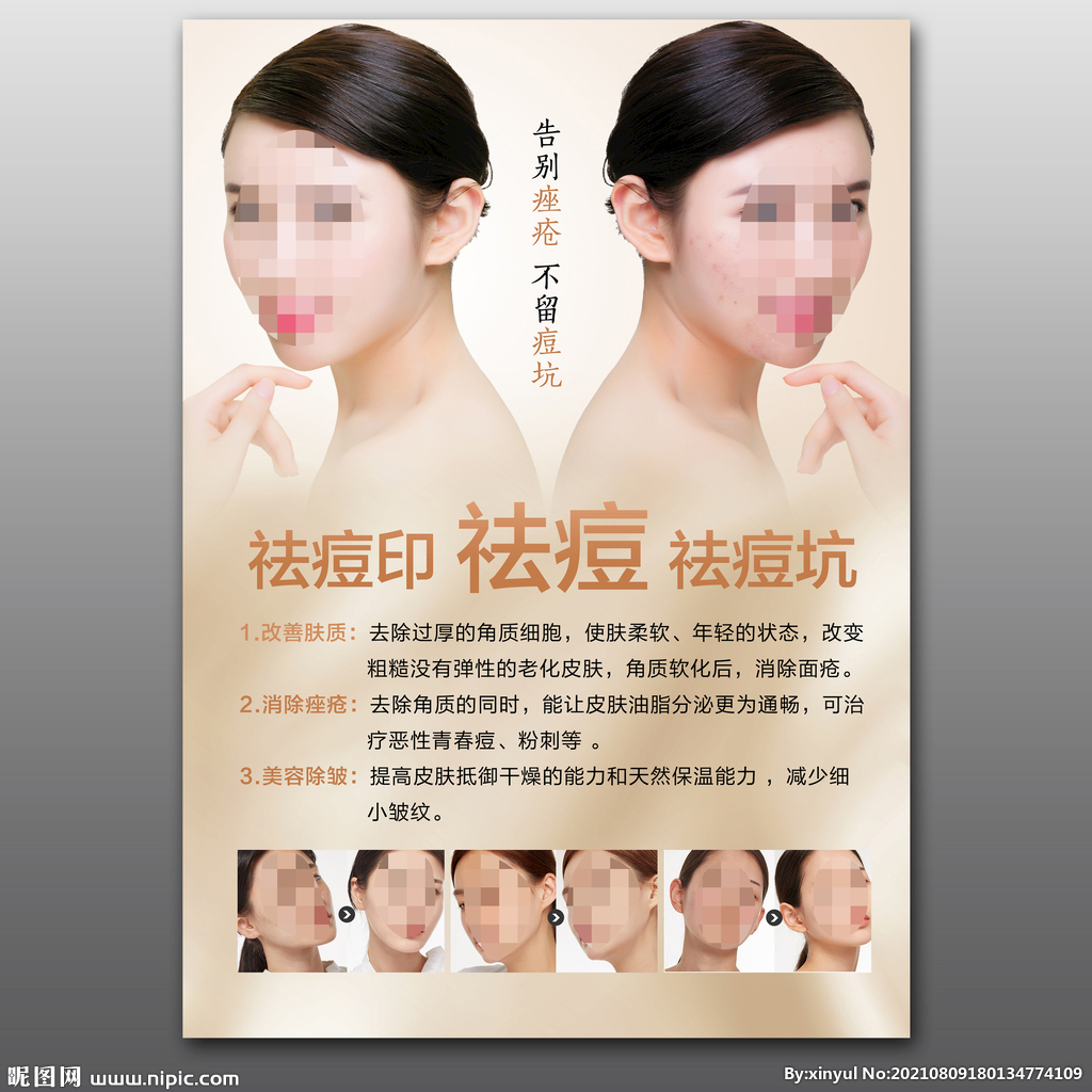 袪痘