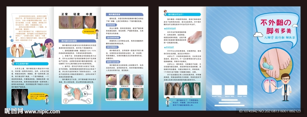 拇外翻