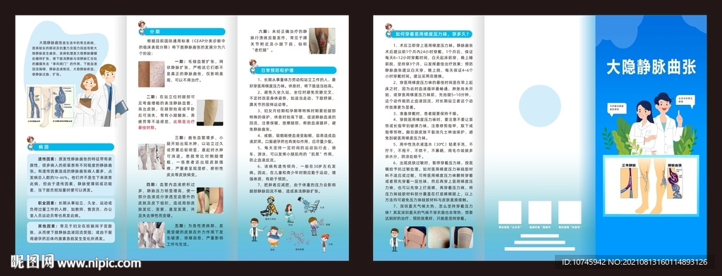静脉曲张