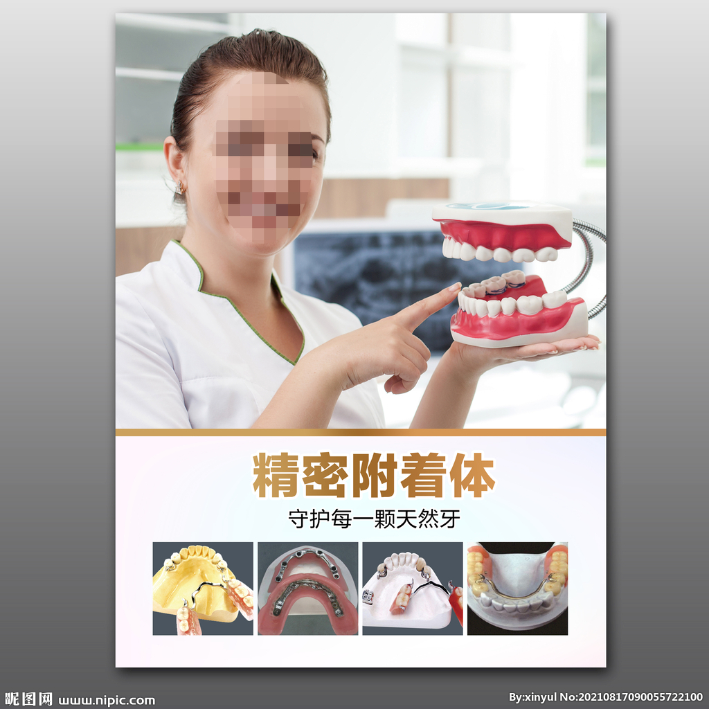 精密附着体