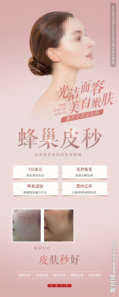 蜂巢皮秒