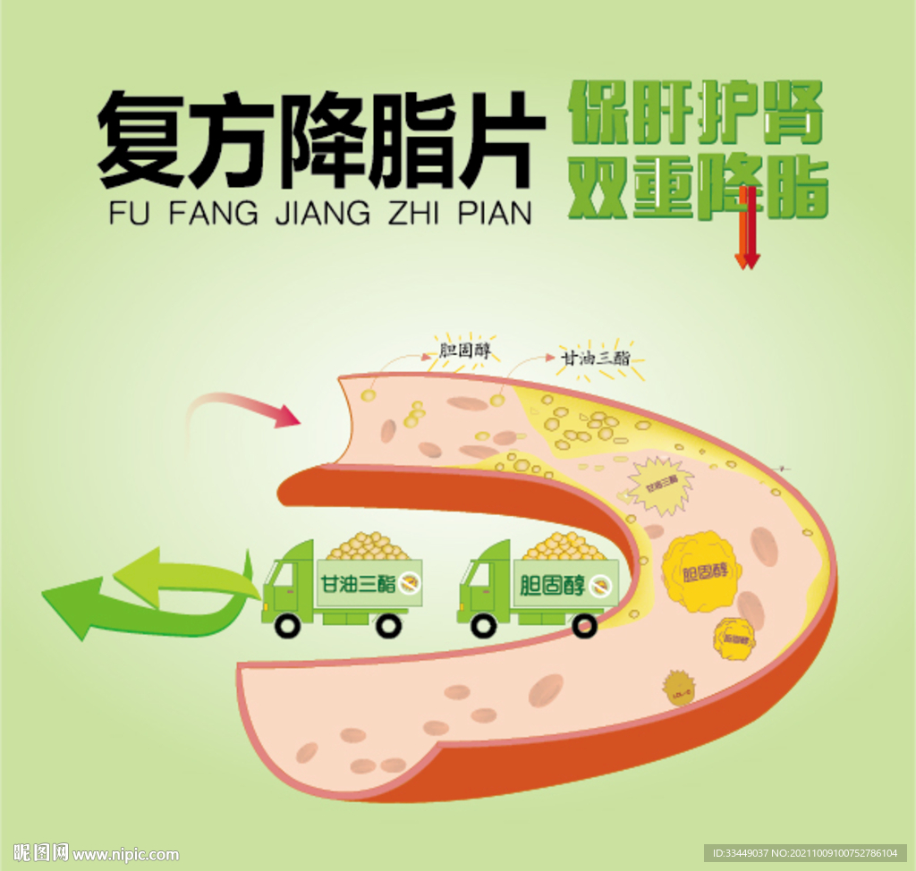 胆固醇阻塞血管降血脂插画