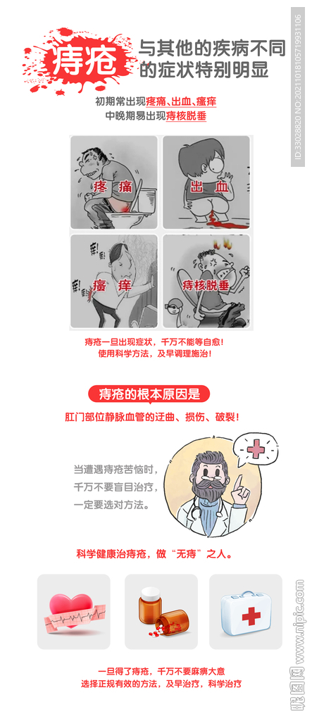 痔疮科普