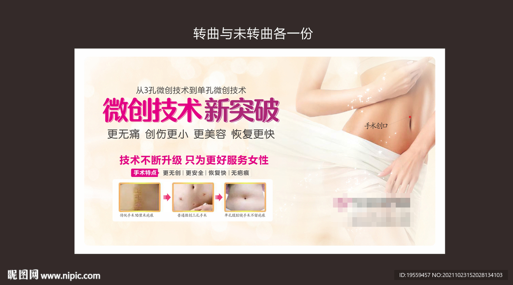 单孔腹腔镜
