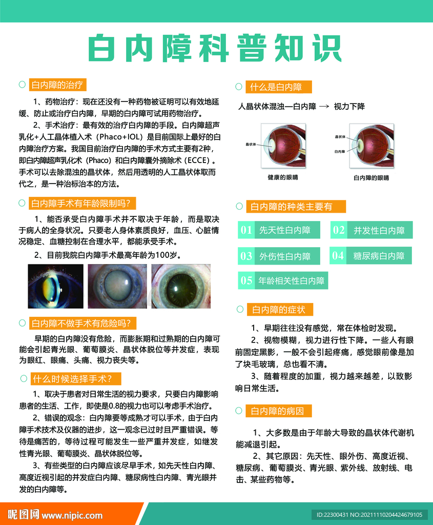 白内障海报