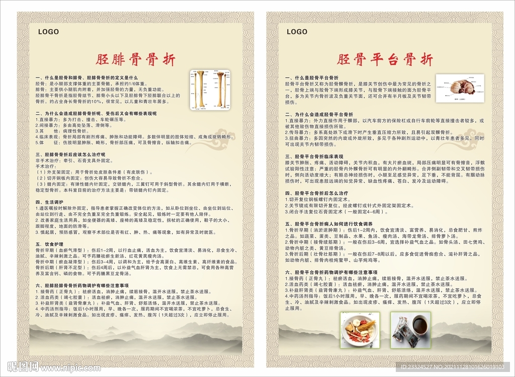 胫腓骨骨折 胫骨平台骨折