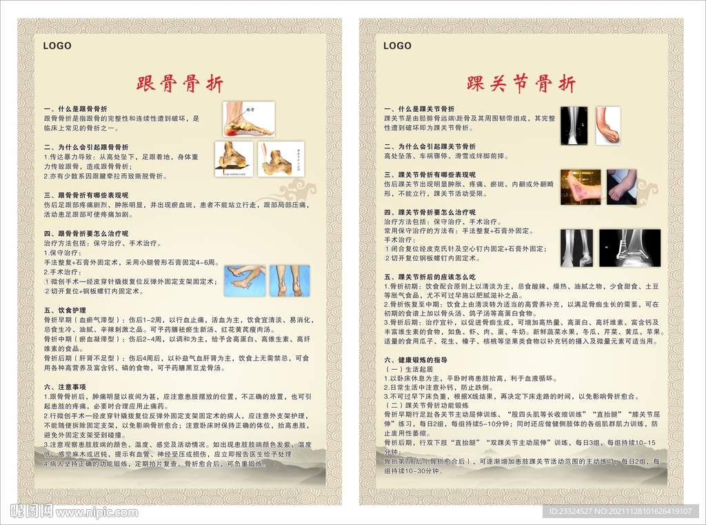 跟骨骨折 踝关节骨折