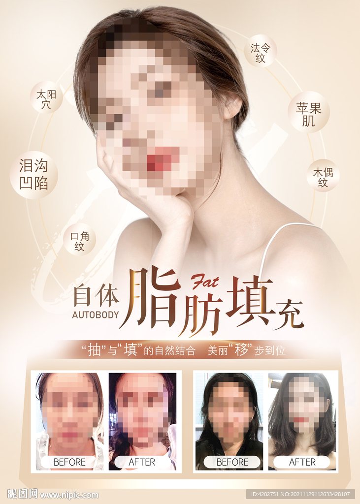 医美自体脂肪填充玻尿酸电梯海报