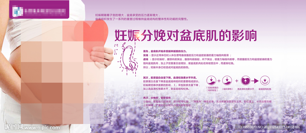 妊娠分娩对盆底肌的影响展板