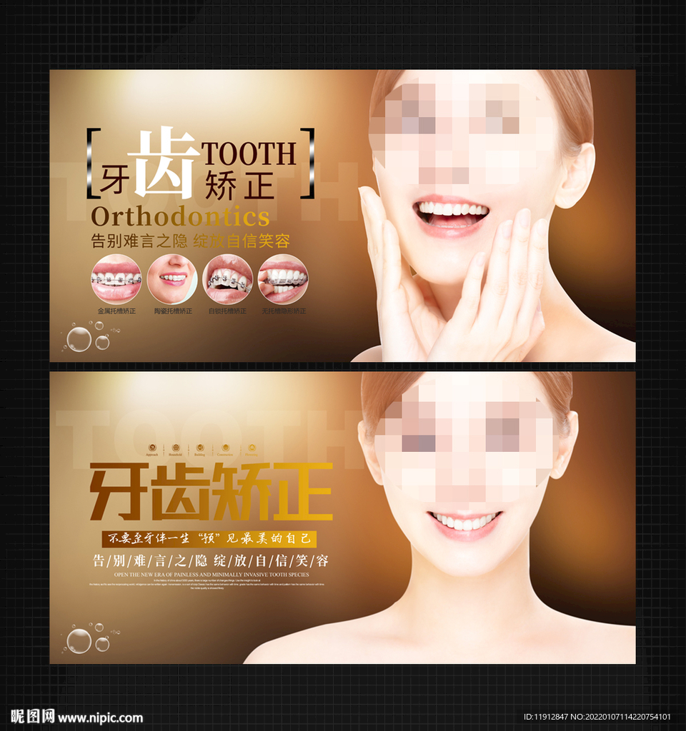 牙齿矫正